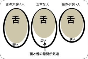 顎と舌の隙間比較の図