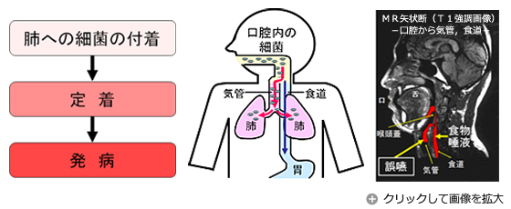 介護